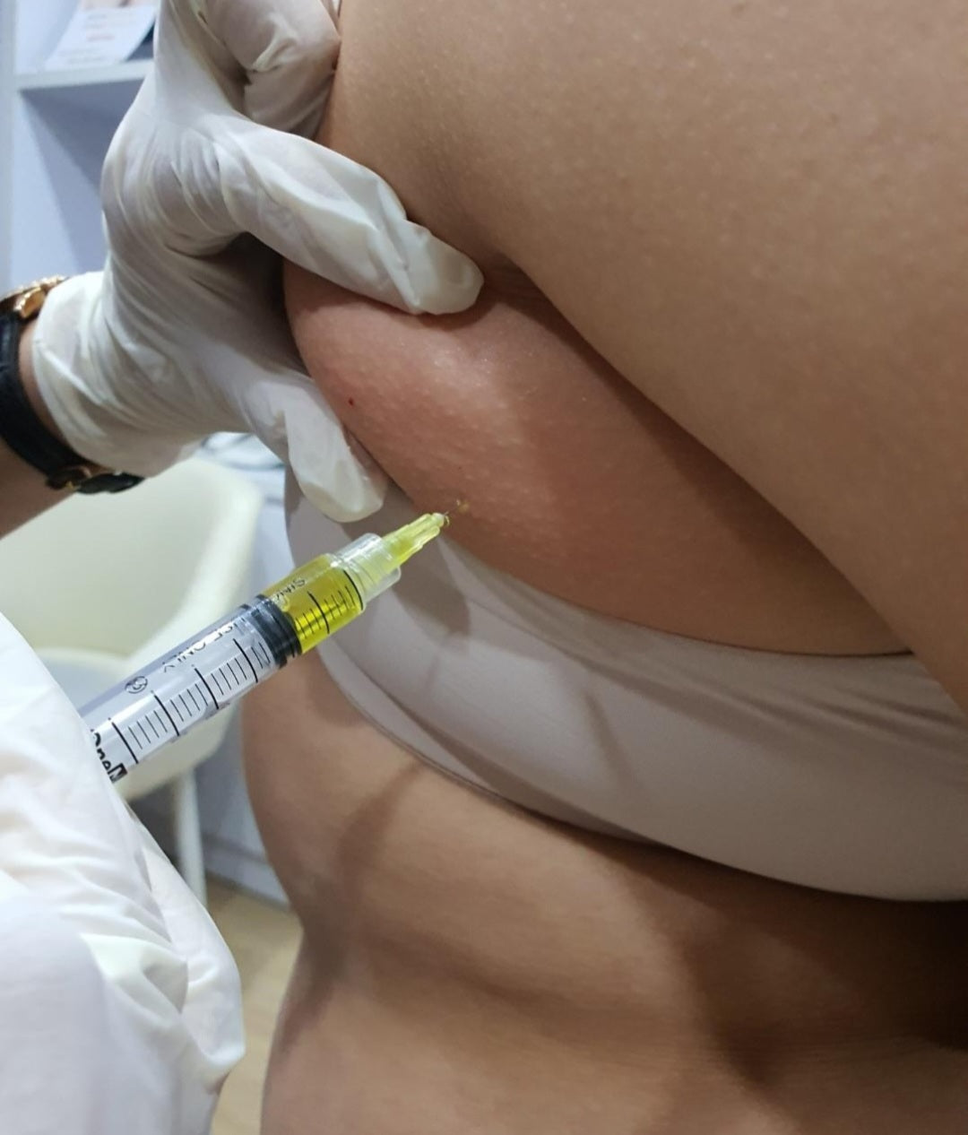 Can you do Fat Dissolving Treatments at Home?